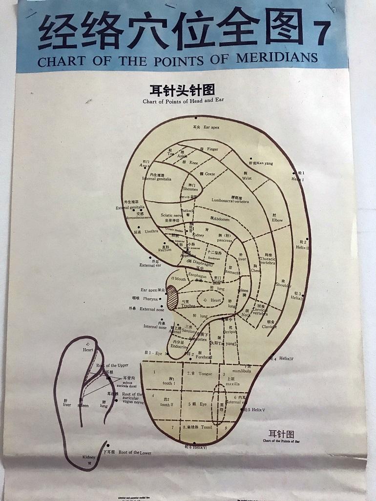 06: Puntos de acupuntura del oído humano, Acupuntura y Medicina Oriental Shen Nong (Filadelfia). Foto: Hong-Kai Wang